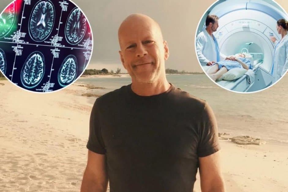 L'acteur Bruce Willis souffre de démence selon ses médecins