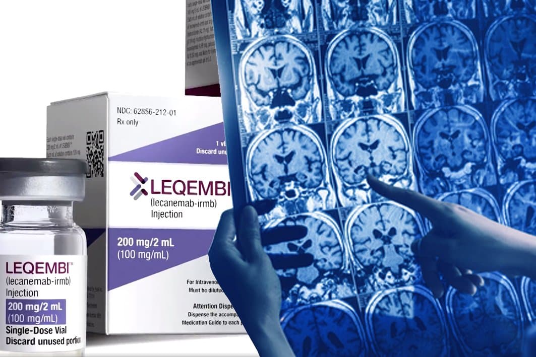 USA : la FDA autorise un nouveau traitement contre la maladie d'Alzheimer