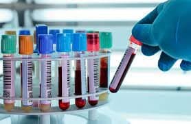 Les Experts appellent à l'élaboration d'un plan de dépistage du cancer thoracique au Maroc