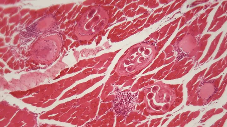 Un kebab de viande d'ours infecte une famille américaine avec des vers du cerveau trouvés dans le porc