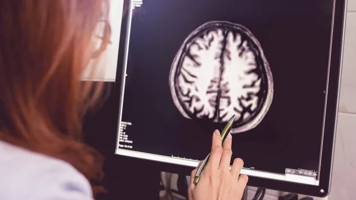 Des experts américains recommandent d'approuver le médicament d'Eli Lilly contre la maladie d'Alzheimer