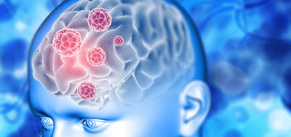 Méningite: une infection mortelle en forte progression en France