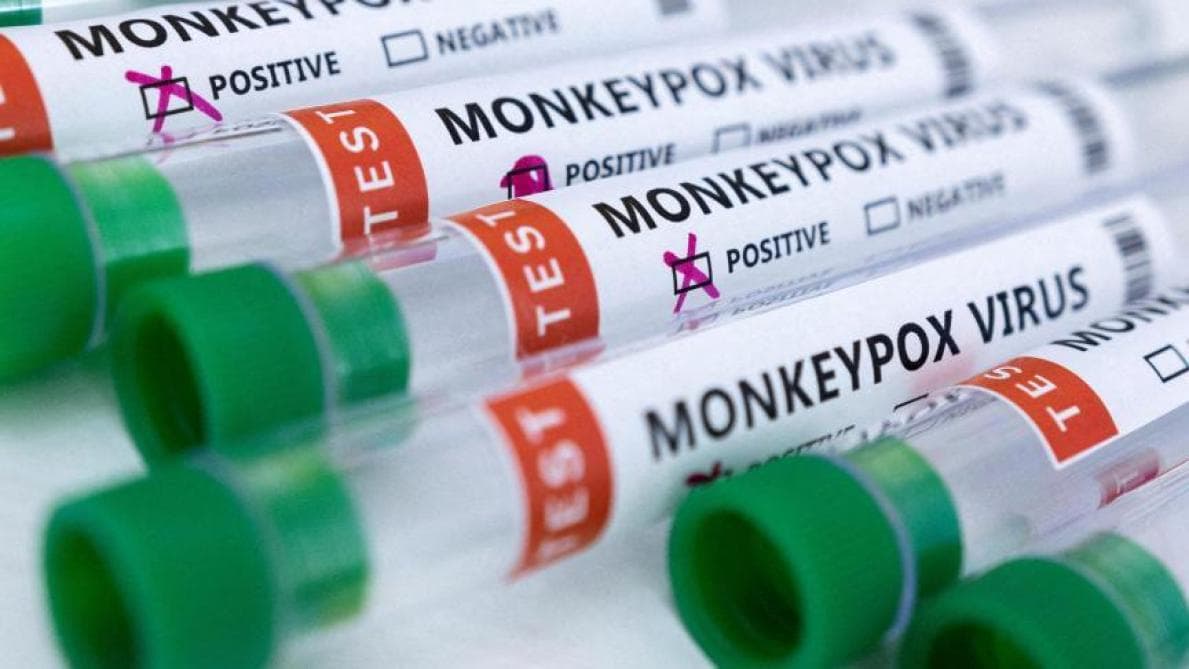Variole du singe : 6 603 cas et 32 décès en Afrique