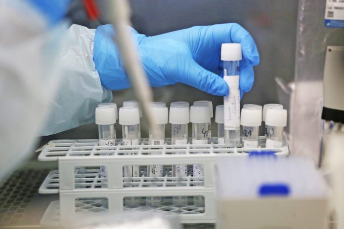 Científicos descubren un método para bloquear la infección del coronavirus