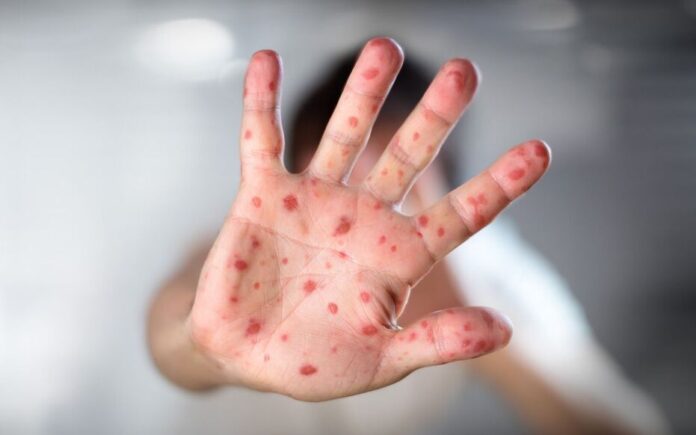 IUGYCZ53NNWOXYGYT4HNWCJIPU